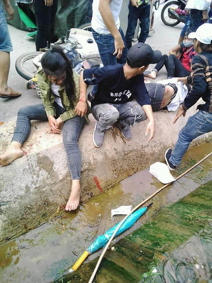 Có 1 cô gái bị gãy tay sau vụ tai nạn