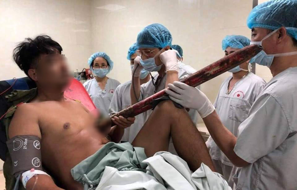 Người đàn ông bị thanh sắt đâm trúng ngực được đưa vào bệnh viện E Hà Nội