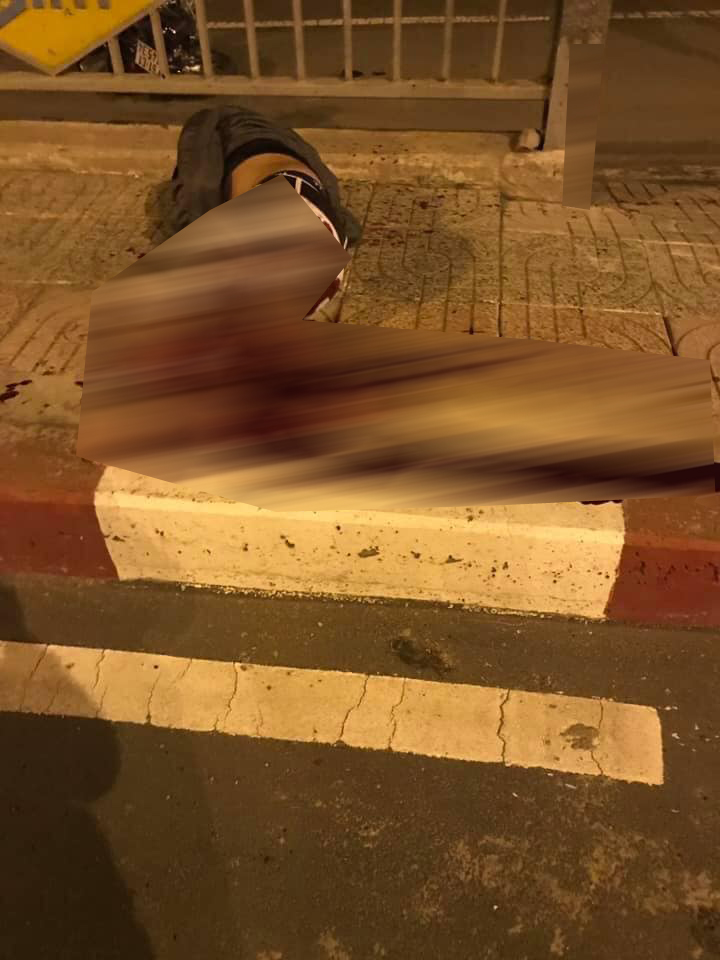 Nam thanh niên văng lên thành cầu nằm và bị đứt lìa 1 chân