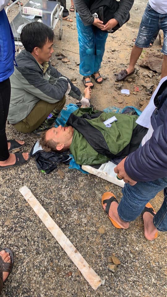 Du khách nước ngoài bị thương nặng được đưa đi cấp cứu Du khách nước ngoài bị thương nặng được đưa đi cấp cứu