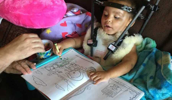 Ngồi sai cách trên ô tô, bé 2 tuổi bị tổn thương cột sống sau tai nạn