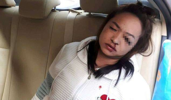 Kẻ mắt trên taxi, người phụ nữ phải trả giá đắt