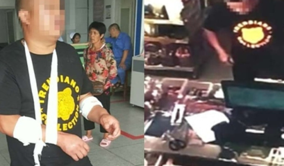 Người đàn ông tự cắt tay giả bị cướp để không phải bỏ ra 2 tỷ Đồng mua xe sang cho bạn gái