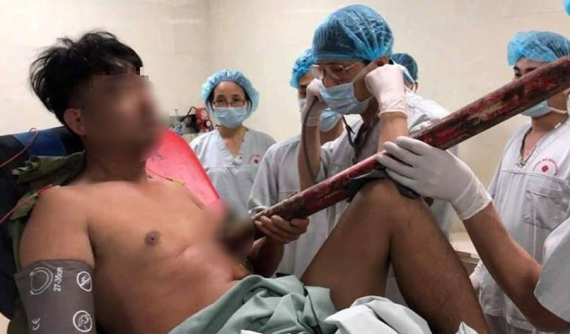 Hà Nội: Hyundai Grand i10 tông dải phân cách, người đàn ông ngồi trên ghế trước bị thanh sắt đâm trúng ngực