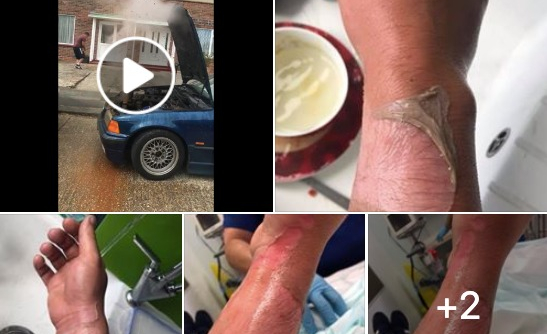 Đây là lý do tại sao bạn không mở nắp két nước làm mát ô tô khi nó... đang sôi sùng sục