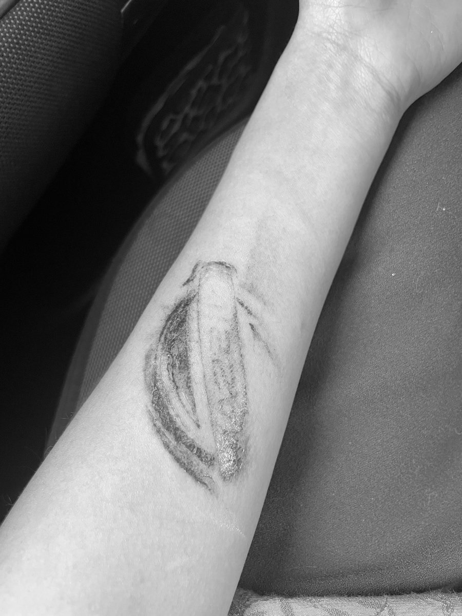 Vết thương hình logo xe Nissan của cô Juarez 